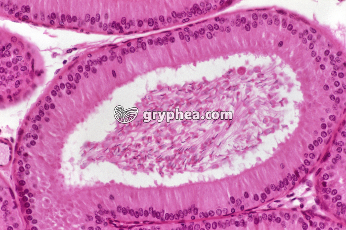 Epididyme x100 - gryphea.com